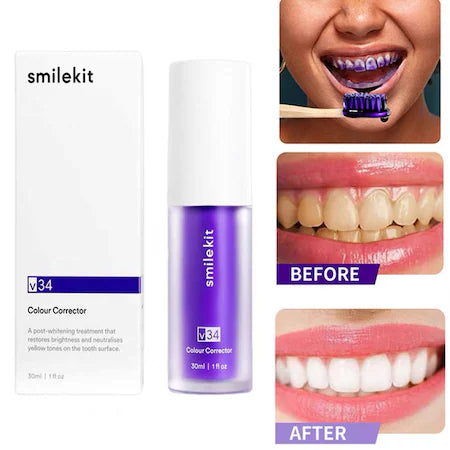 Spuma Eficienta V34 SmileKit Pentru Albirea Dintilor 30ml